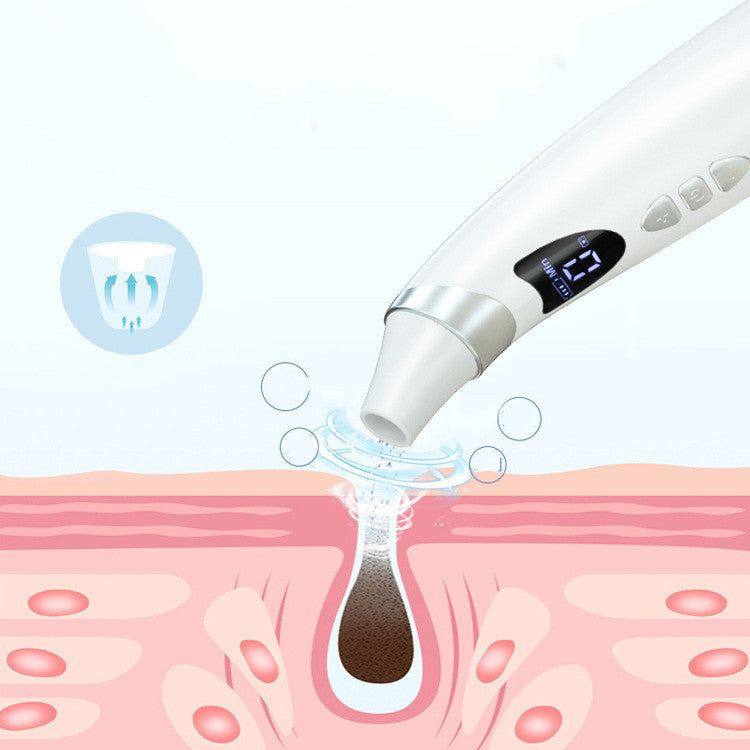 Smart Electric Pore Cleaner with HD Camera – Deep Blackhead Remover & Skin Care Tool
