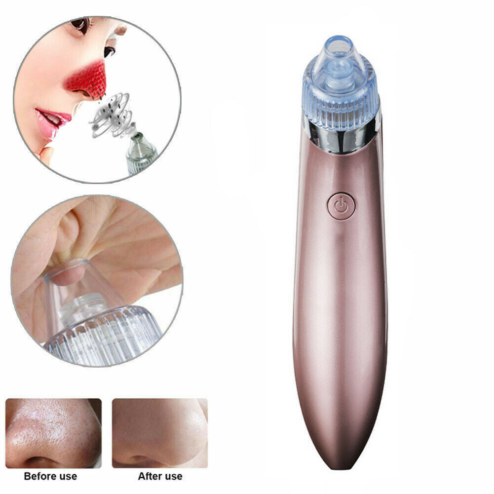 Electric Blackhead Remover Vacuum – Deep Pore Cleaner & Acne Suction Tool for Flawless Skin