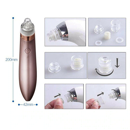Electric Blackhead Remover Vacuum – Deep Pore Cleaner & Acne Suction Tool for Flawless Skin