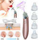 Electric Blackhead Remover Vacuum – Deep Pore Cleaner & Acne Suction Tool for Flawless Skin