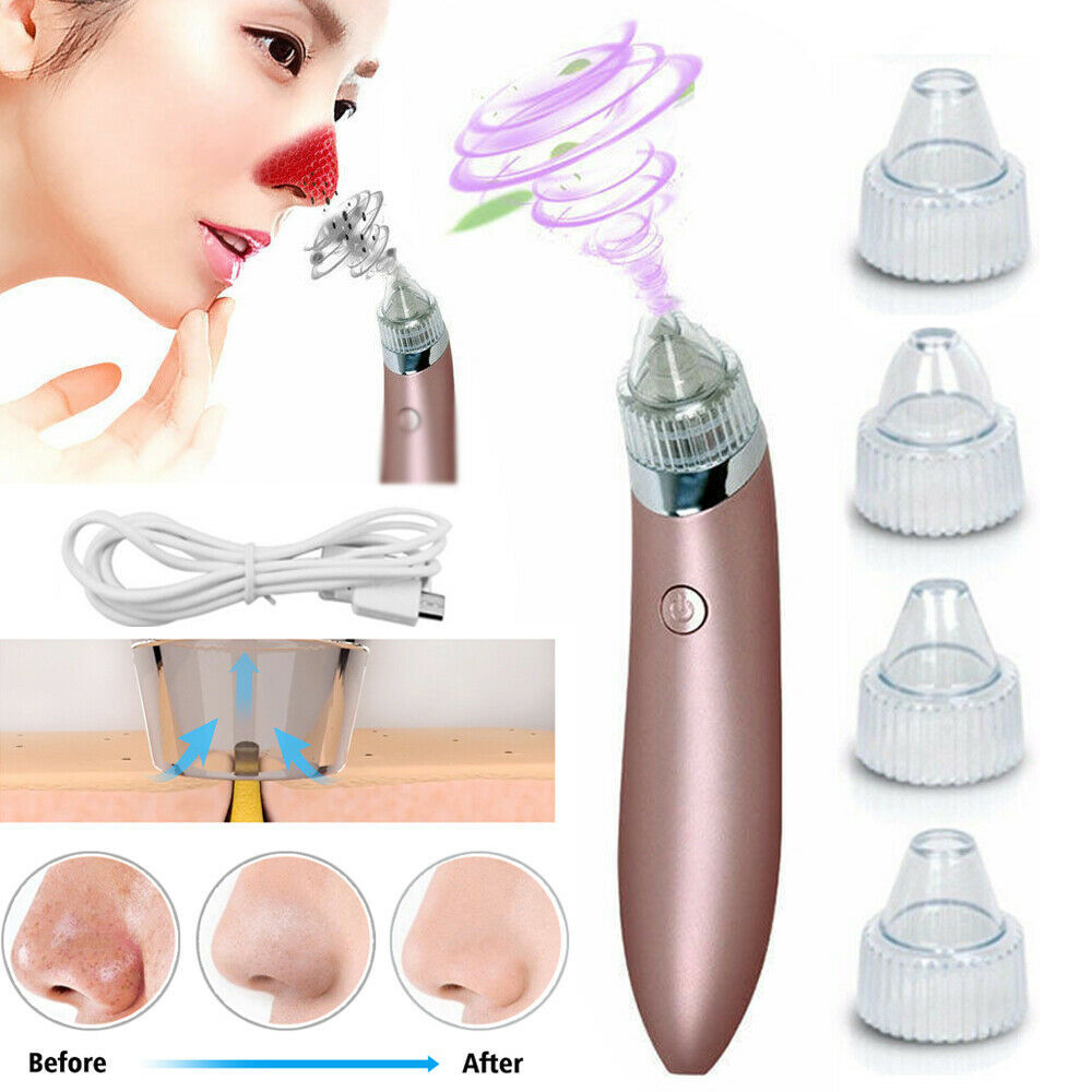 Electric Blackhead Remover Vacuum – Deep Pore Cleaner & Acne Suction Tool for Flawless Skin
