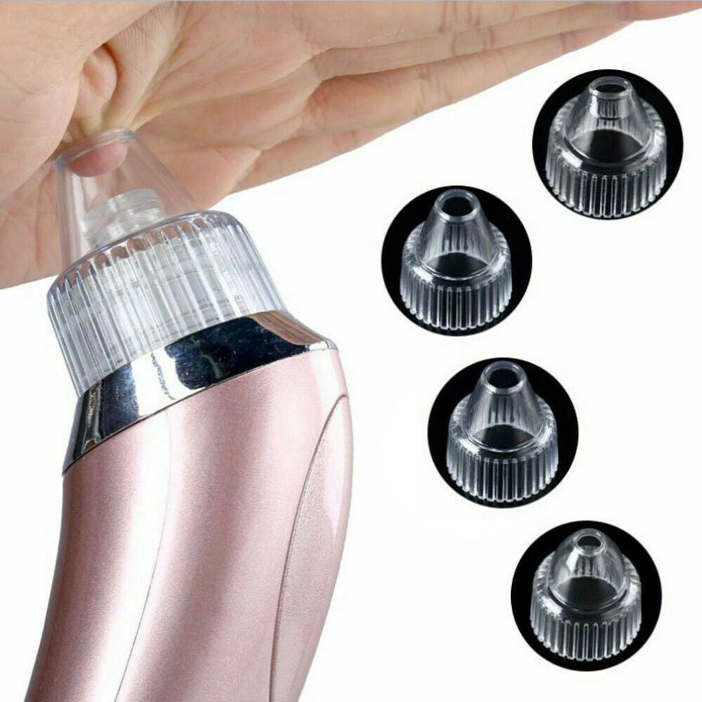 Electric Blackhead Remover Vacuum – Deep Pore Cleaner & Acne Suction Tool for Flawless Skin