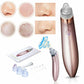 Electric Blackhead Remover Vacuum – Deep Pore Cleaner & Acne Suction Tool for Flawless Skin